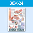 Плакат «Синдром запястного канала (кистевой туннельный синдром)» (ЗОЖ-24, пластик 2 мм, A1, 1 лист)